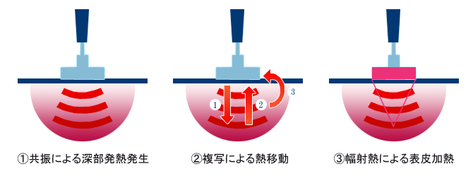 共振による深部発熱発生、複写による熱移動、幅射熱による表皮加熱